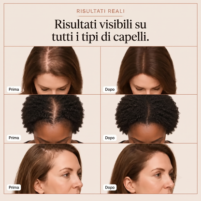 Siero Capillare Elvonya
