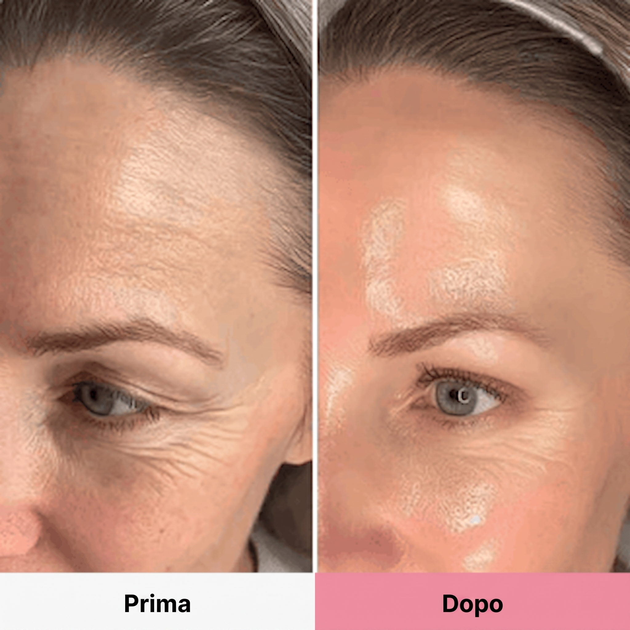 PDRN Collagene Volume Balsamo